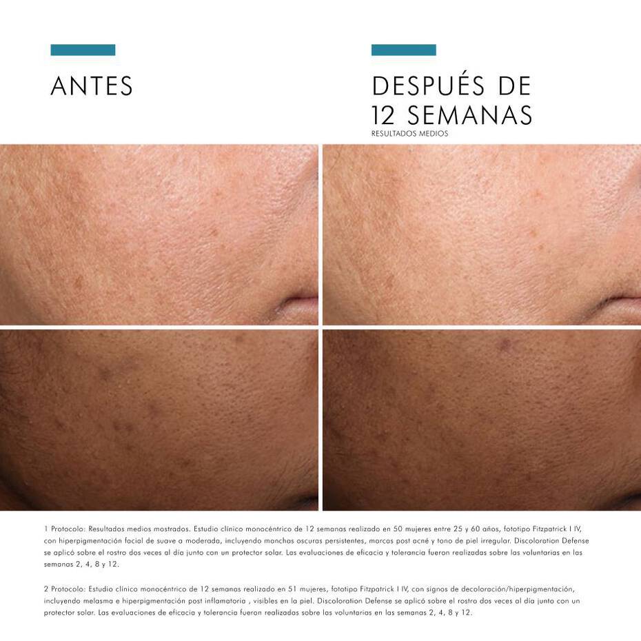 DISCOLORATION DEFENSE SkinCeuticals | antiedad, antioxidante, hidratante, piel seca | Revitalaser