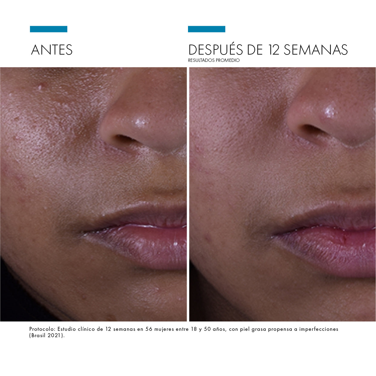 SILYMARIN CF
