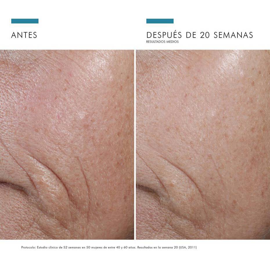 C E FERULIC Skinceuticals | antiedad, antioxidante, hidratante, piel seca | Revitalaser